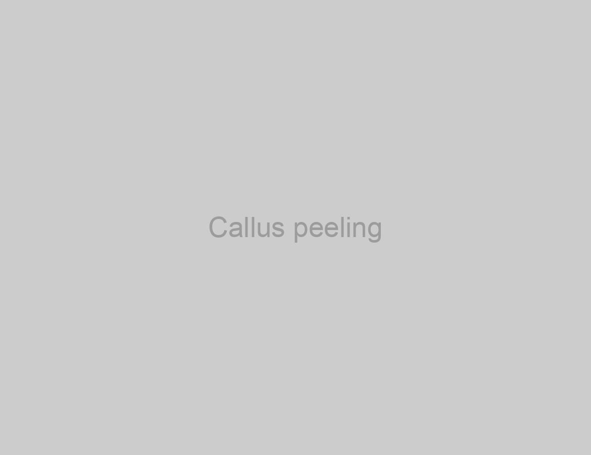 Callus peeling